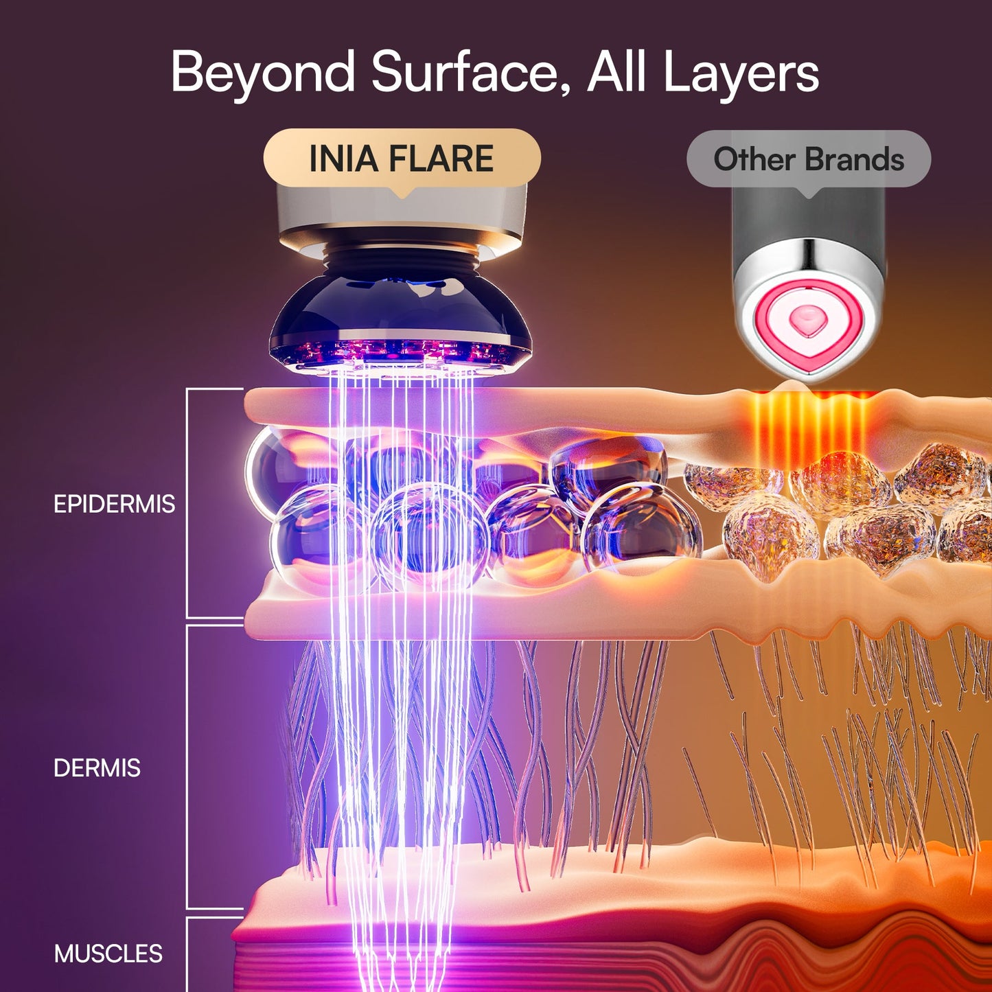IONA™ Microcurrent Facial Sculptor