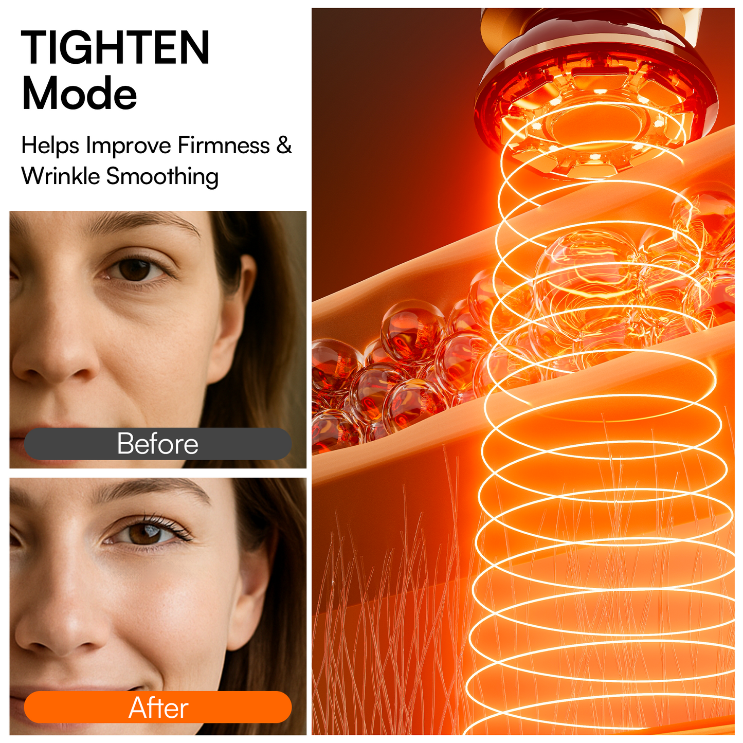 IONA™ Microcurrent Facial Sculptor