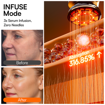 IONA™ Microcurrent Facial Sculptor