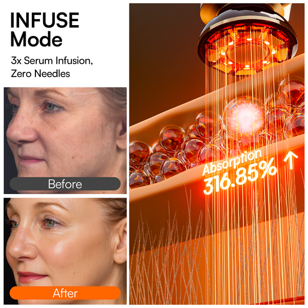 IONA™ Microcurrent Facial Sculptor